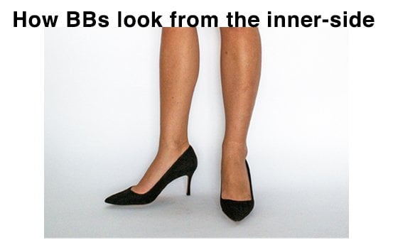 BBs inner-side