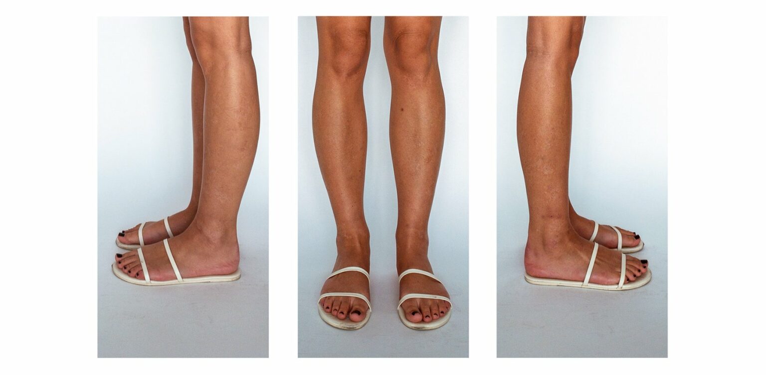 TKEES Flip Flops Review: These are Sandals a Flop